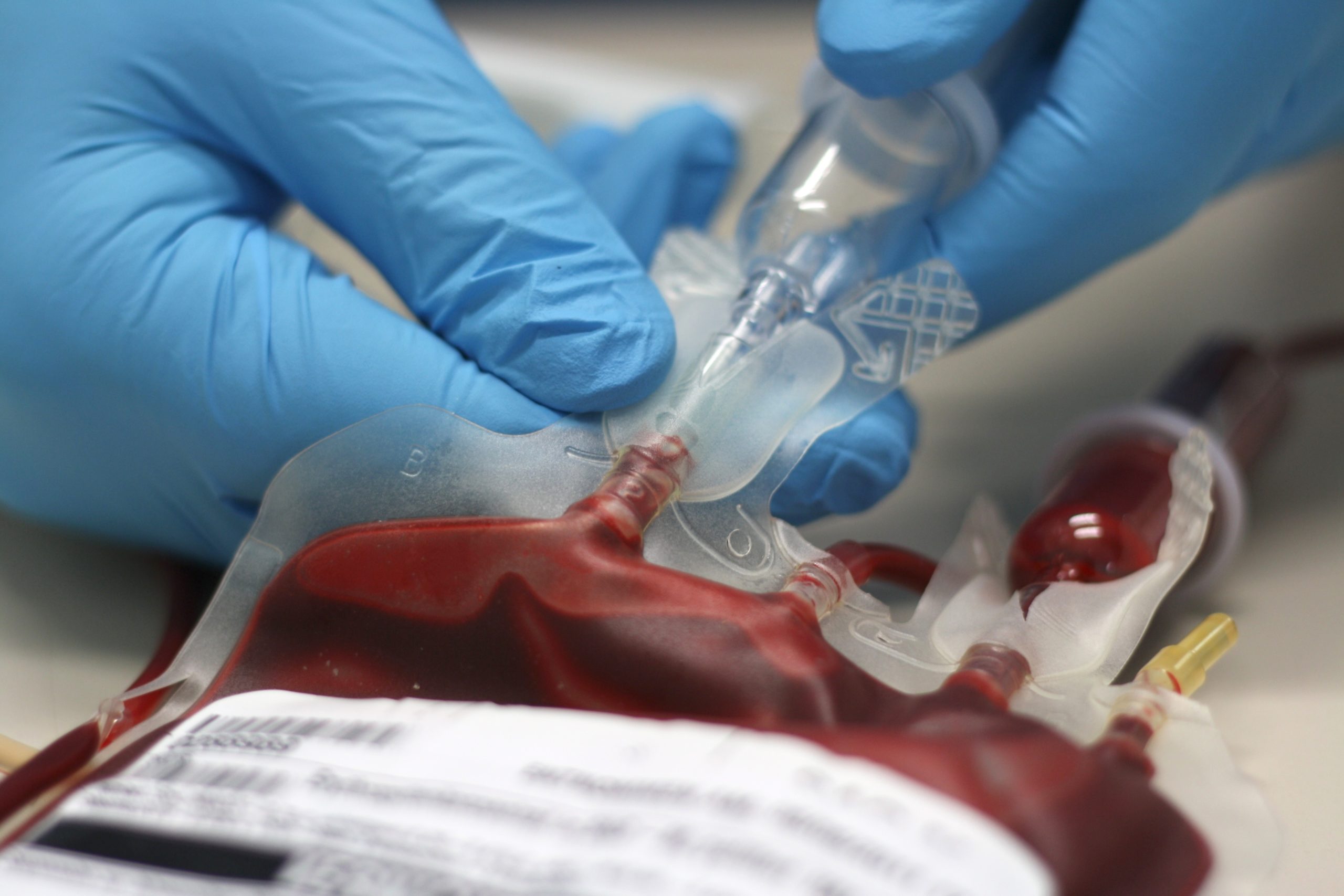 RBC transfusion